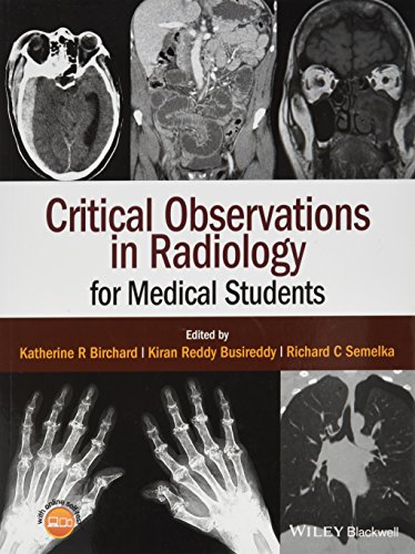 Stock image for Critical Observations in Radiology for Medical Students for sale by ThriftBooks-Atlanta