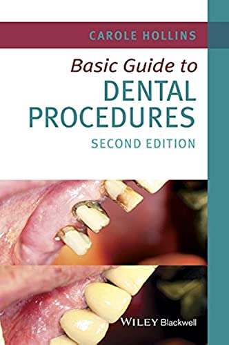 Stock image for Basic Guide to Dental Procedures (Basic Guide Dentistry Series) for sale by Books From California