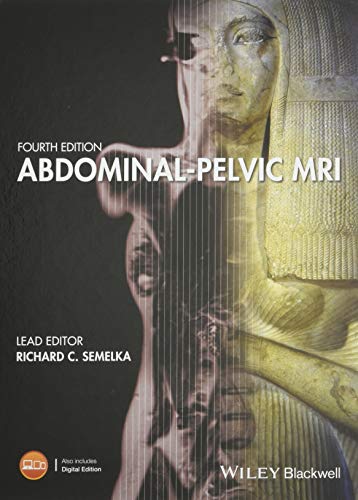 Stock image for Abdominal-Pelvic MRI for sale by Mispah books