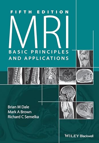 9781119013051: MRI: Basic Principles and Applications