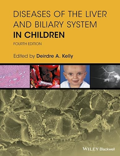 9781119046905: Diseases of the Liver and Biliary System in Children