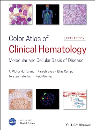 Stock image for Color Atlas of Clinical Hematology: Molecular and Cellular Basis of Disease for sale by medimops