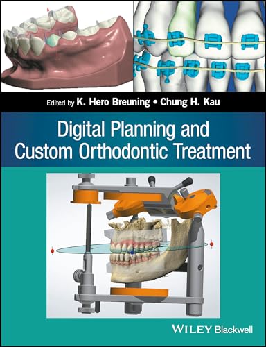 Stock image for Digital Planning and Custom Orthodontic Treatment Format: Paperback for sale by INDOO