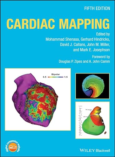 9781119152590: Cardiac Mapping