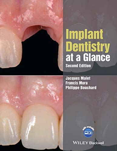 9781119292609: Implant Dentistry at a Glance, 2nd Edition (At a Glance (Dentistry))