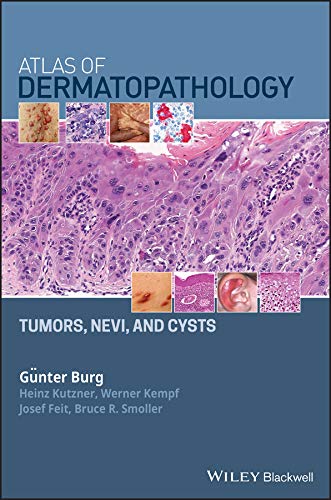 Beispielbild fr Atlas of Dermatopathology: Tumors, Nevi, and Cysts zum Verkauf von HPB-Red