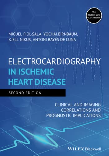 Stock image for Electrocardiography in Ischemic Heart Disease: Clinical and Imaging Correlations and Prognostic Implications for sale by Book Deals