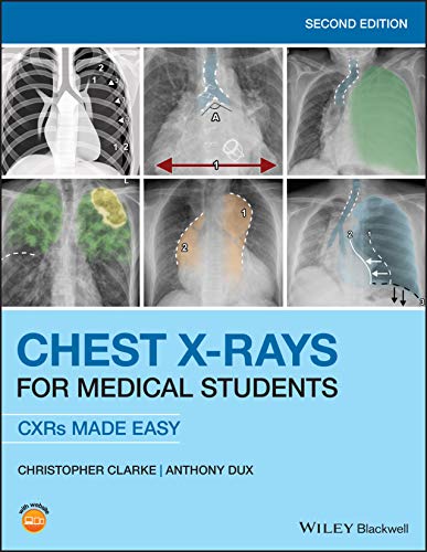 Beispielbild fr Chest X-Rays for Medical Students zum Verkauf von Blackwell's
