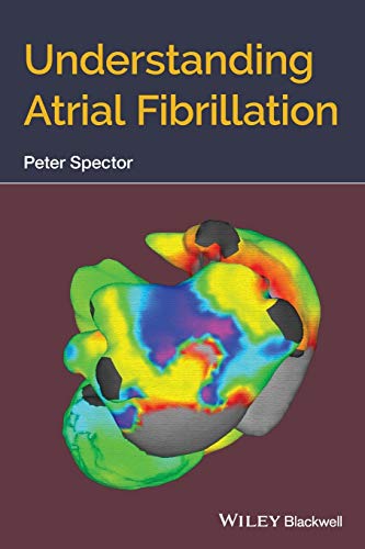Imagen de archivo de Understanding Atrial Fibrillation Format: Paperback a la venta por INDOO
