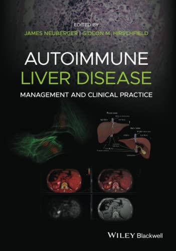 Beispielbild fr Autoimmune Liver Disease: Management and Clinical Practice zum Verkauf von Studibuch