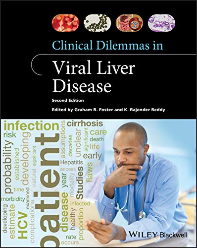 Beispielbild fr Clinical Dilemmas in Viral Liver Disease zum Verkauf von Blackwell's