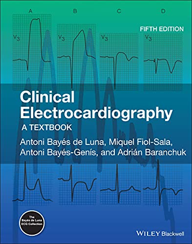 Beispielbild fr Clinical Electrocardiography: A Textbook zum Verkauf von Book Deals