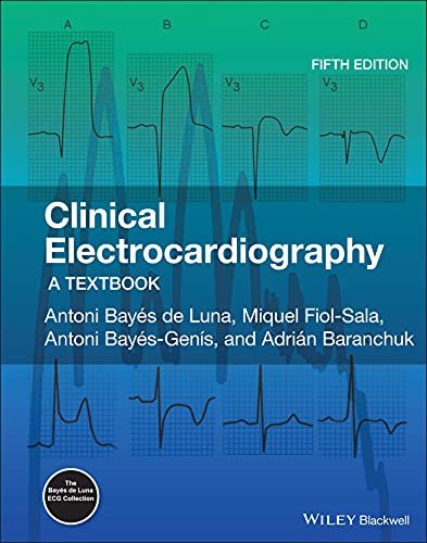 Stock image for Clinical Electrocardiography: A Textbook for sale by TextbookRush