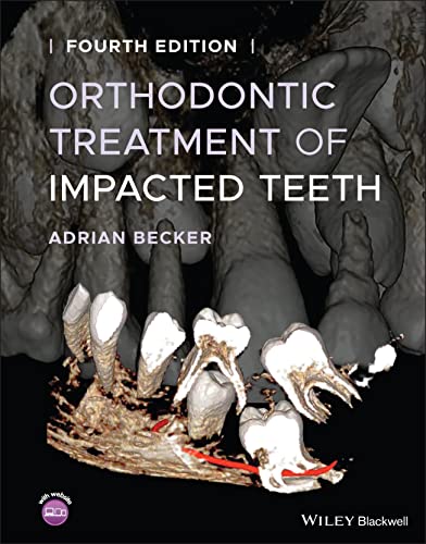 9781119565376: Orthodontic Treatment of Impacted Teeth
