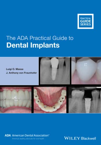 Stock image for The ADA Practical Guide to Dental Implants for sale by Books Unplugged