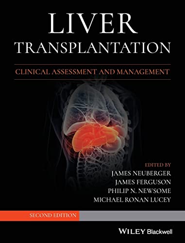 9781119633983: Liver Transplantation: Clinical Assessment and Management