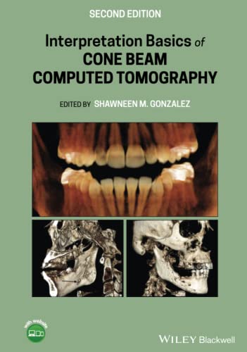 9781119685845: Interpretation Basics of Cone Beam Computed Tomography