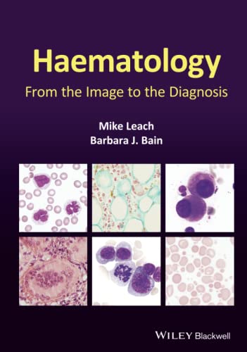 Beispielbild fr Haematology zum Verkauf von Blackwell's