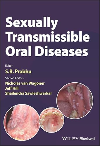 Beispielbild fr Sexually Transmissible Oral Diseases zum Verkauf von Blackwell's