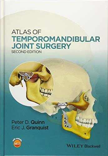 Stock image for Atlas of Temporomandibular Joint Surgery for sale by Blackwell's