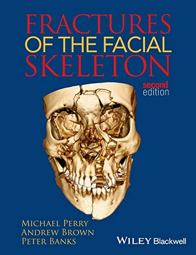 Fractures of the Facial Skeleton - Michael Perry|Andrew Brown|Peter Banks