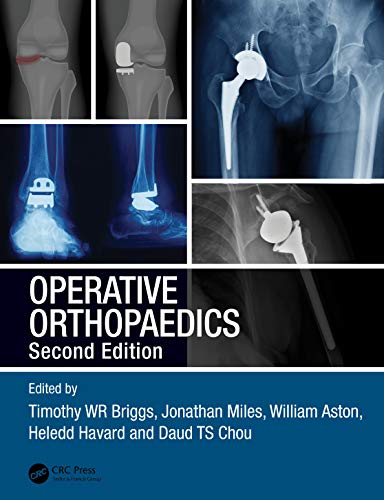 Stock image for Operative Orthopaedics 2Ed (Pb 2021) for sale by Basi6 International