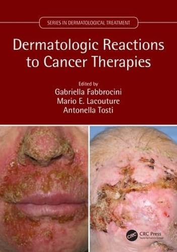 Beispielbild fr Dermatologic Reactions to Cancer Therapies zum Verkauf von Blackwell's