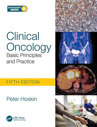 Stock image for Clinical Oncology: Basic Principles and Practice for sale by Inspire Trading