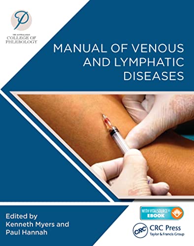 Stock image for Manual of Venous and Lymphatic Diseases for sale by Blackwell's