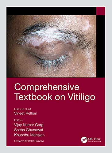 Stock image for Comprehensive Textbook on Vitiligo for sale by AHA-BUCH GmbH