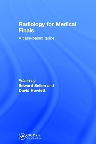Stock image for Radiology for Medical Finals: A case-based guide for sale by Chiron Media
