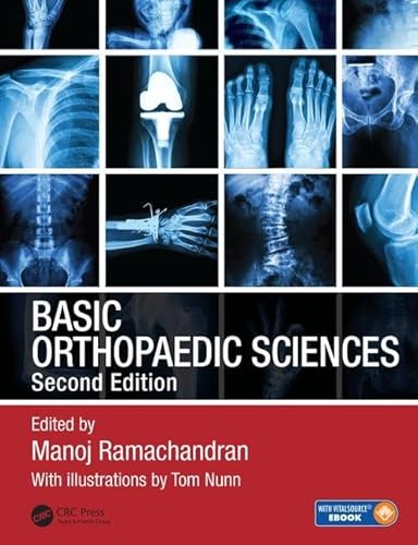 9781138091726: Basic Orthopaedic Sciences