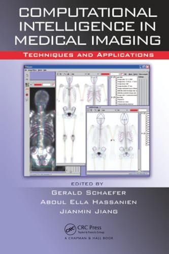 9781138112209: Computational Intelligence in Medical Imaging: Techniques and Applications