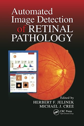 Beispielbild fr Automated Image Detection of Retinal Pathology zum Verkauf von Blackwell's