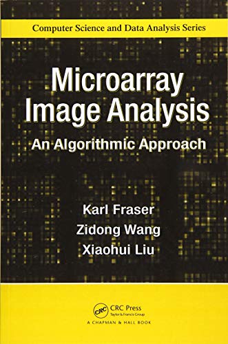 Stock image for Microarray Image Analysis for sale by Blackwell's