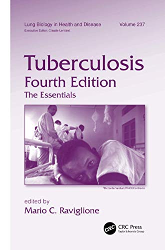 9781138117662: Tuberculosis: The Essentials, Fourth Edition (Lung Biology in Health and Disease)