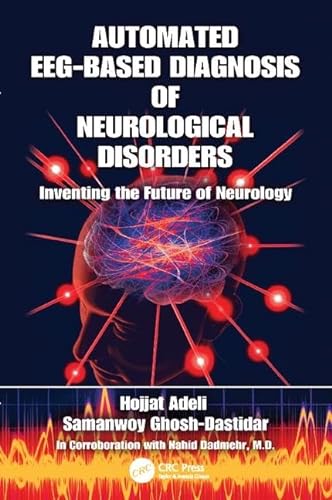 Stock image for Automated EEG-Based Diagnosis of Neurological Disorders for sale by Blackwell's
