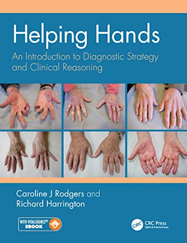 9781138330825: Helping Hands: An Introduction to Diagnostic Strategy and Clinical Reasoning