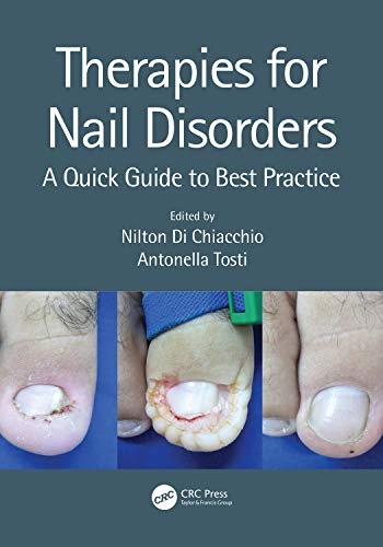 9781138370364: Therapies for Nail Disorders: A Quick Guide to Best Practice