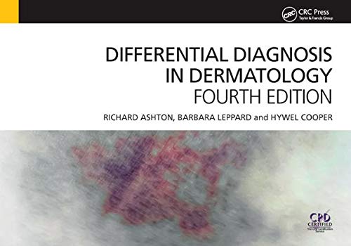 Imagen de archivo de Differential Diagnosis in Dermatology a la venta por Buchpark