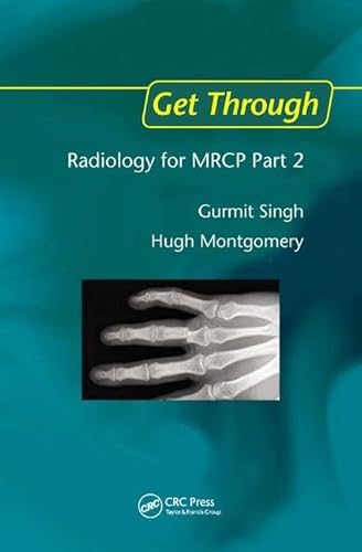 Stock image for Get Through Radiology for Mrcp: Vol 2 for sale by Revaluation Books