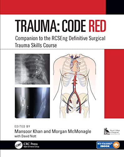 9781138477018: Trauma: Code Red: Companion to the RCSEng Definitive Surgical Trauma Skills Course
