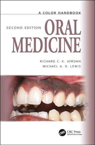 Stock image for Oral Medicine 2Ed (Pb 2013) for sale by Books Puddle