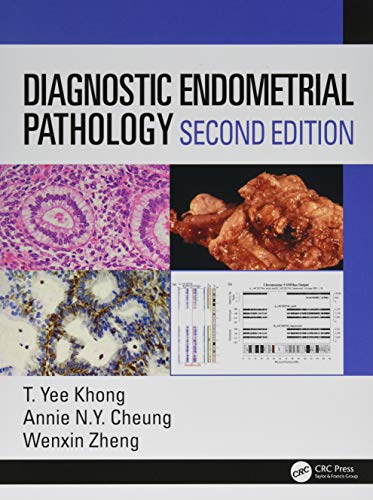 Stock image for DIAGNOSTIC ENDOMETRIAL PATHOLOGY 2ED (HB 2019) for sale by Romtrade Corp.