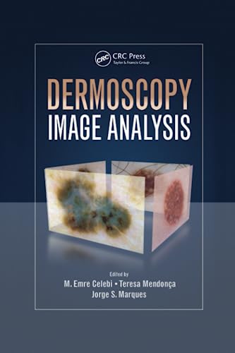 Stock image for Dermoscopy Image Analysis for sale by Blackwell's