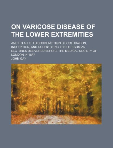 On varicose disease of the lower extremities; and its allied disorders skin discoloration, induration, and ucler being the Lettsomian Lectures delivered before the Medical Society of London in 1867 (9781151322456) by Gay, John