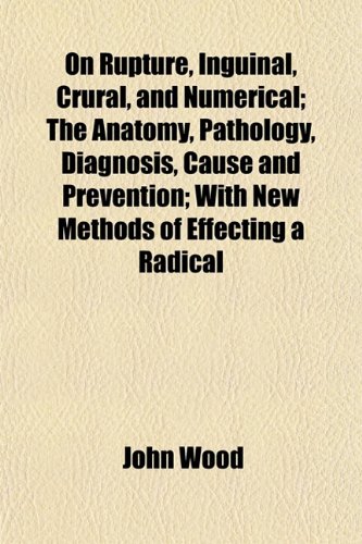 On Rupture, Inguinal, Crural, and Numerical; The Anatomy, Pathology, Diagnosis, Cause and Prevention; With New Methods of Effecting a Radical (9781152030961) by Wood, John