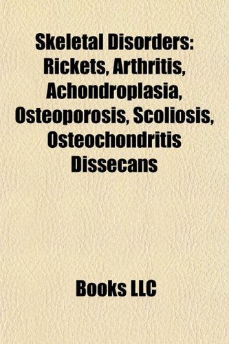 9781156605608: Skeletal disorders: Rickets, Arthritis, Achondroplasia, ICD-10 Chapter XVII: Congenital malformations: Rickets, Arthritis, Achondroplasia, ICD-10 ... imperfecta, Osteosarcoma, Transient synovitis