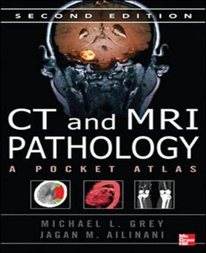 9781259251405: CT & MRI Pathology: A Pocket Atlas, Second Edition (Int'l Ed) (APPLETON & LANGE MED IE OVRUNS)