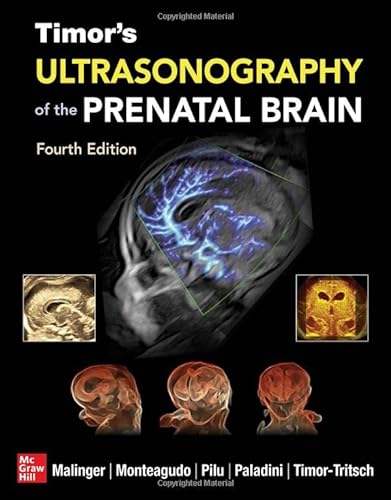 Imagen de archivo de Timor's Ultrasonography of the Prenatal Brain, Fourth Edition a la venta por GF Books, Inc.